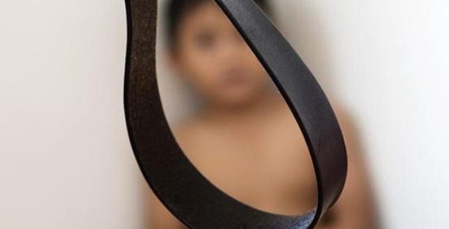 طفل يتعرض للضرب من معلمه في جدة والرأي العام يتحرك!