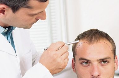 ماهو افضل مركز لزراعة الشعر في تركيا