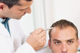 ماهو افضل مركز لزراعة الشعر في تركيا