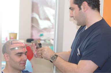 تكلفة زراعة الشعر في السعودية