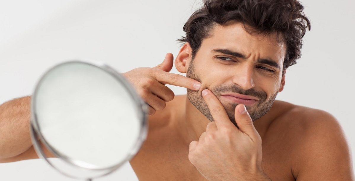اسباب ظهور حب الشباب