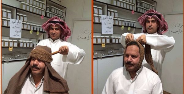 بدأ علاج التنسيم (cupping.khayma)