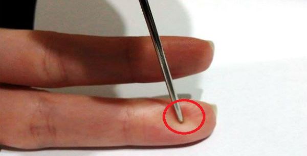 وخز الأصابع