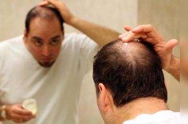 تكثيف الشعر الخفيف