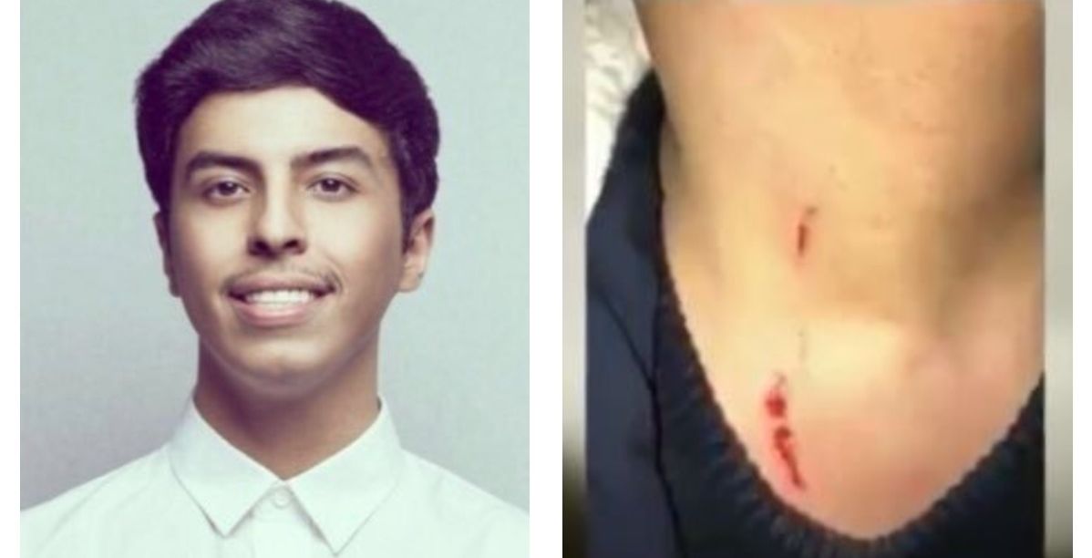 وافد اجنبي يعتدي على اعلامي سعودي