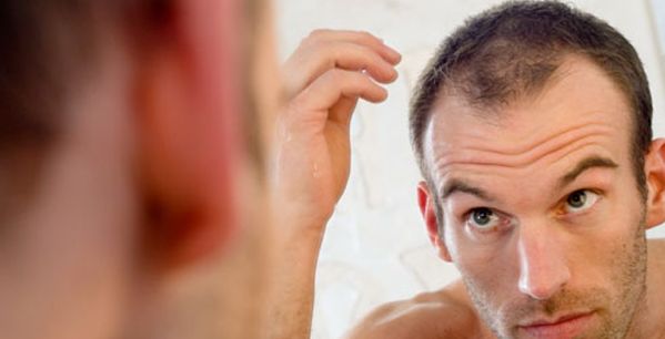 خلطات لعلاج تساقط الشعر للرجال