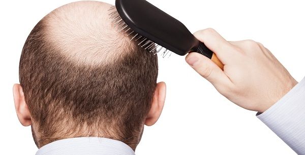 افضل مراكز زراعة الشعر في السعودية