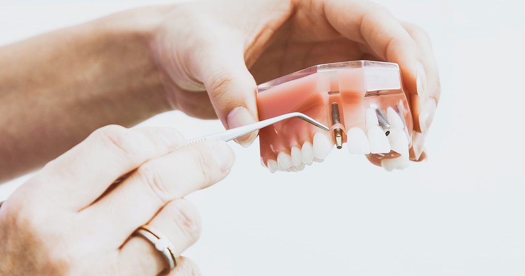 التنظيف بين الأسنان (الخيط الطبي)