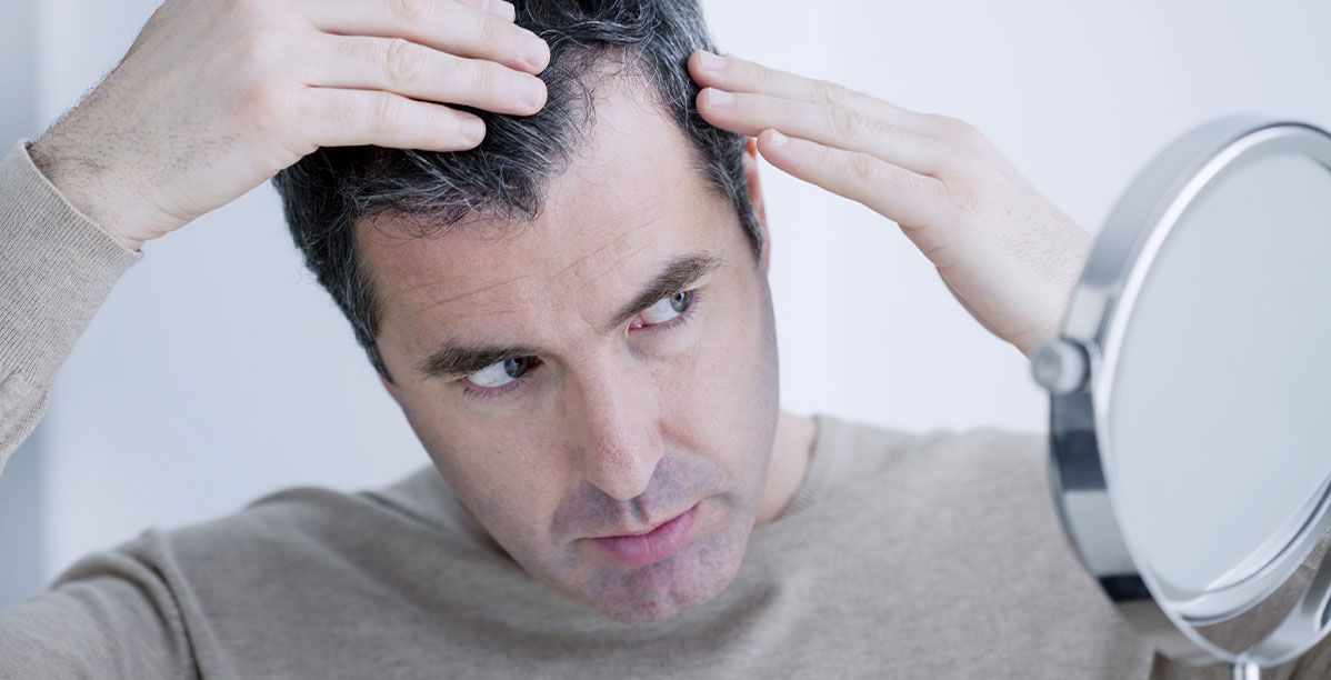 أسباب تساقط الشعر عند الشباب وعلاجها