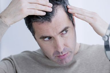 أسباب تساقط الشعر عند الشباب وعلاجها