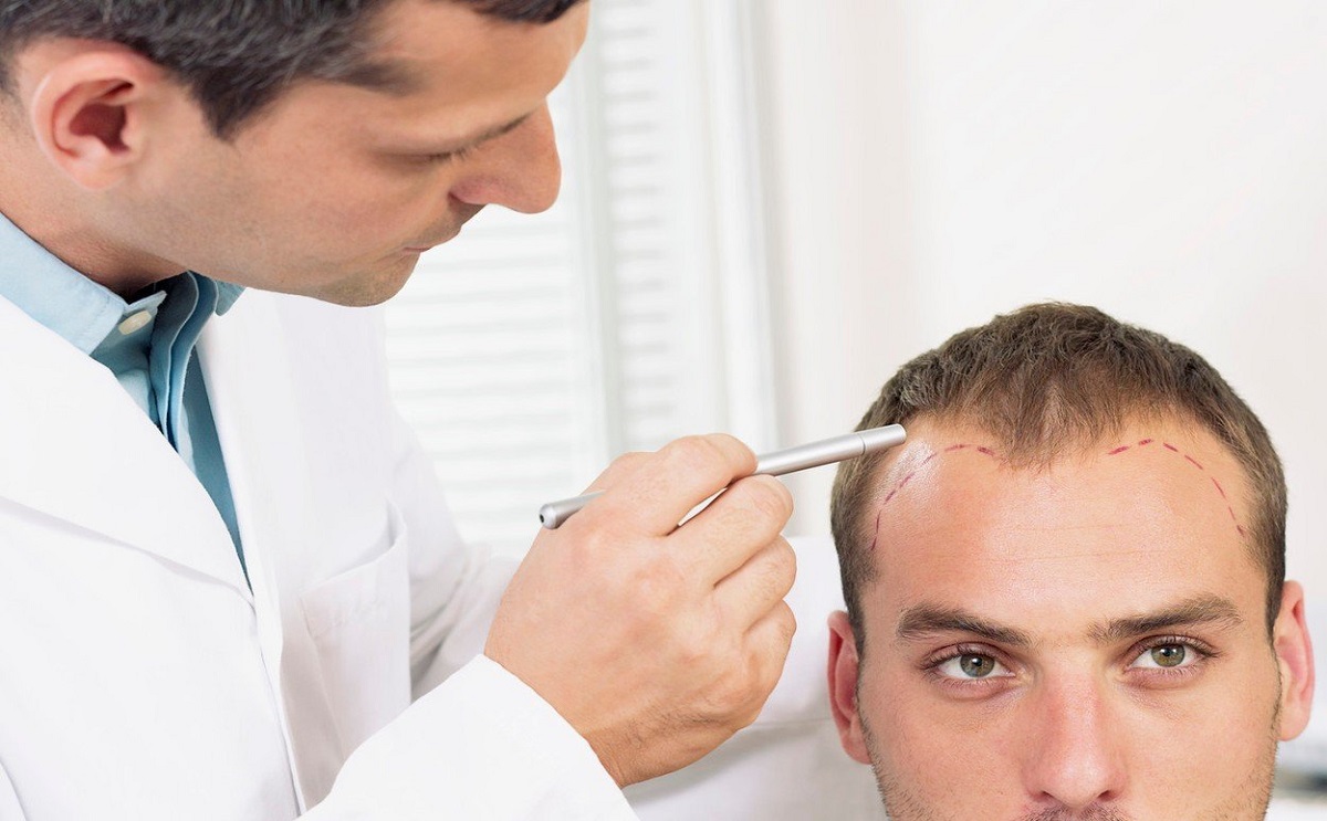 ماهو افضل مركز لزراعة الشعر في تركيا