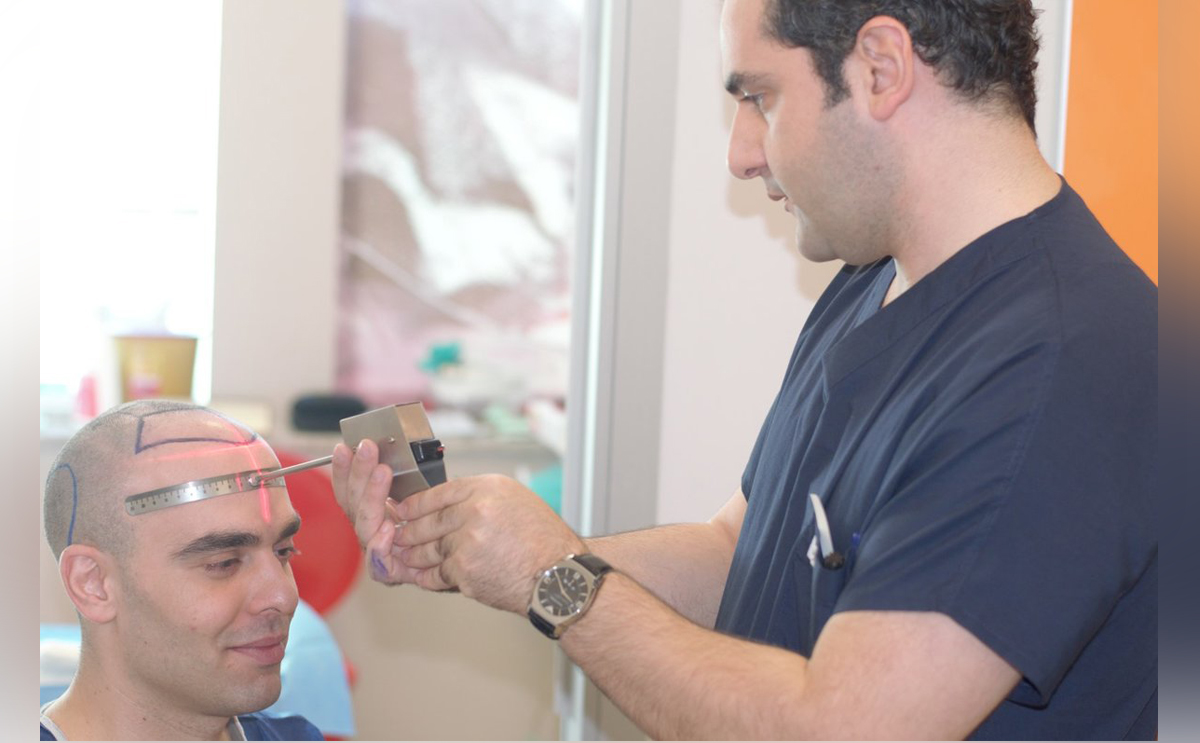 تكلفة زراعة الشعر في السعودية