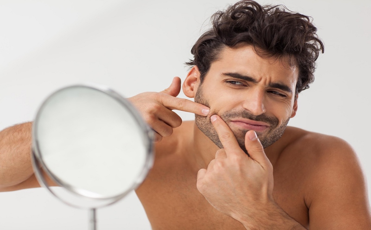 اسباب ظهور حب الشباب