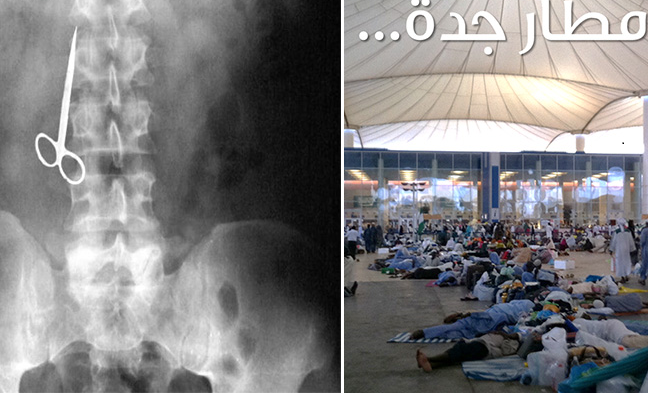 المقص