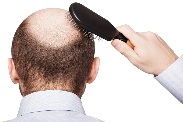 افضل مراكز زراعة الشعر في السعودية